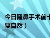 今日隆鼻手术前十大注意事项（隆鼻后多久恢复自然）