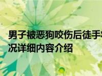 男子被恶狗咬伤后徒手将狗掐死 并未找到狗主人是谁具体情况详细内容介绍