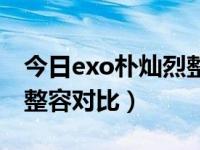 今日exo朴灿烈整容对比图（今日exo朴灿烈整容对比）