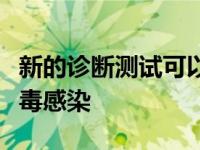 新的诊断测试可以帮助更快地检测出呼吸道病毒感染